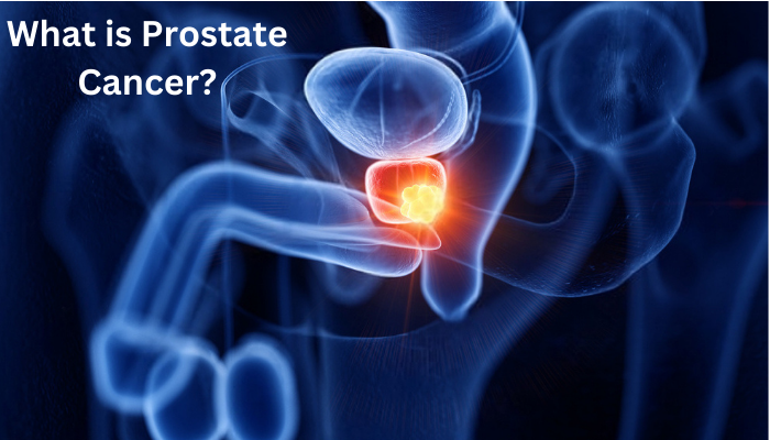 Oncologist in Dubai explaining prostate cancer causes, symptoms, and treatment options.